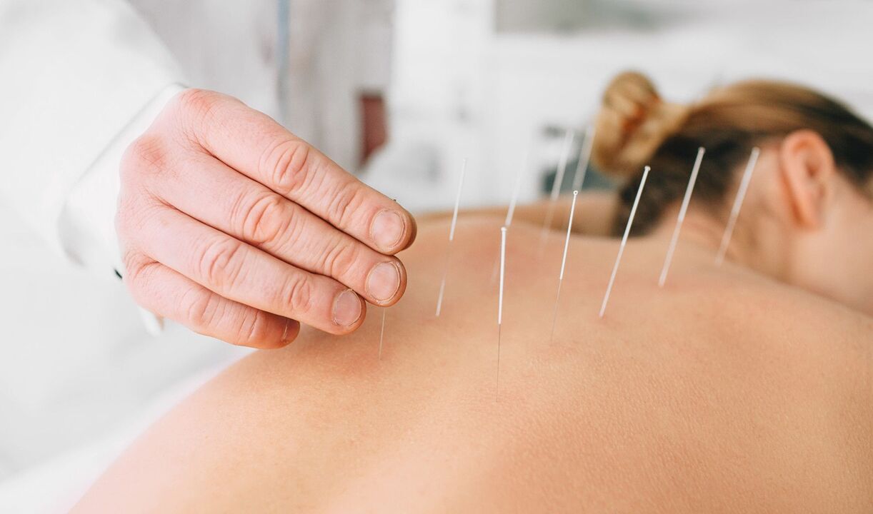 acupuncture anti-tabac